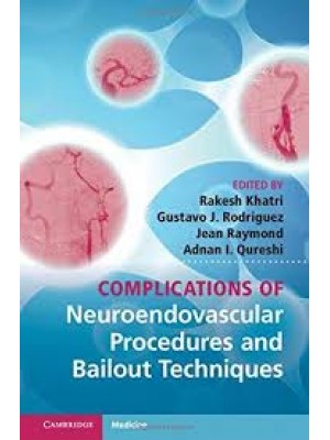 Complications of Neuroendovascular Procedures and Bailout Techniques 